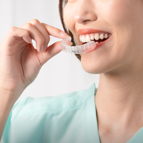 マウスピース矯正