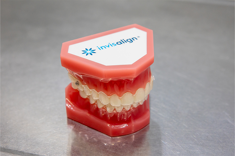 なごみのマウスピース矯正が選ばれる理由