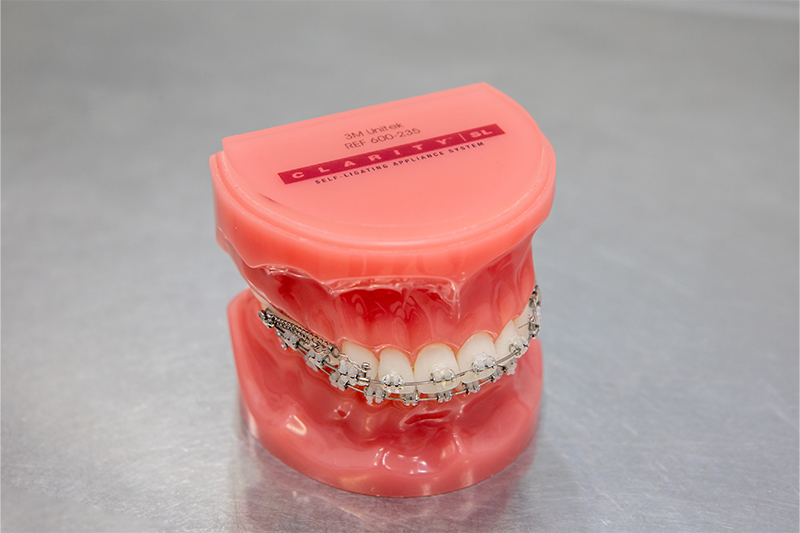 見た目だけじゃない。“咬める”を整える矯正治療